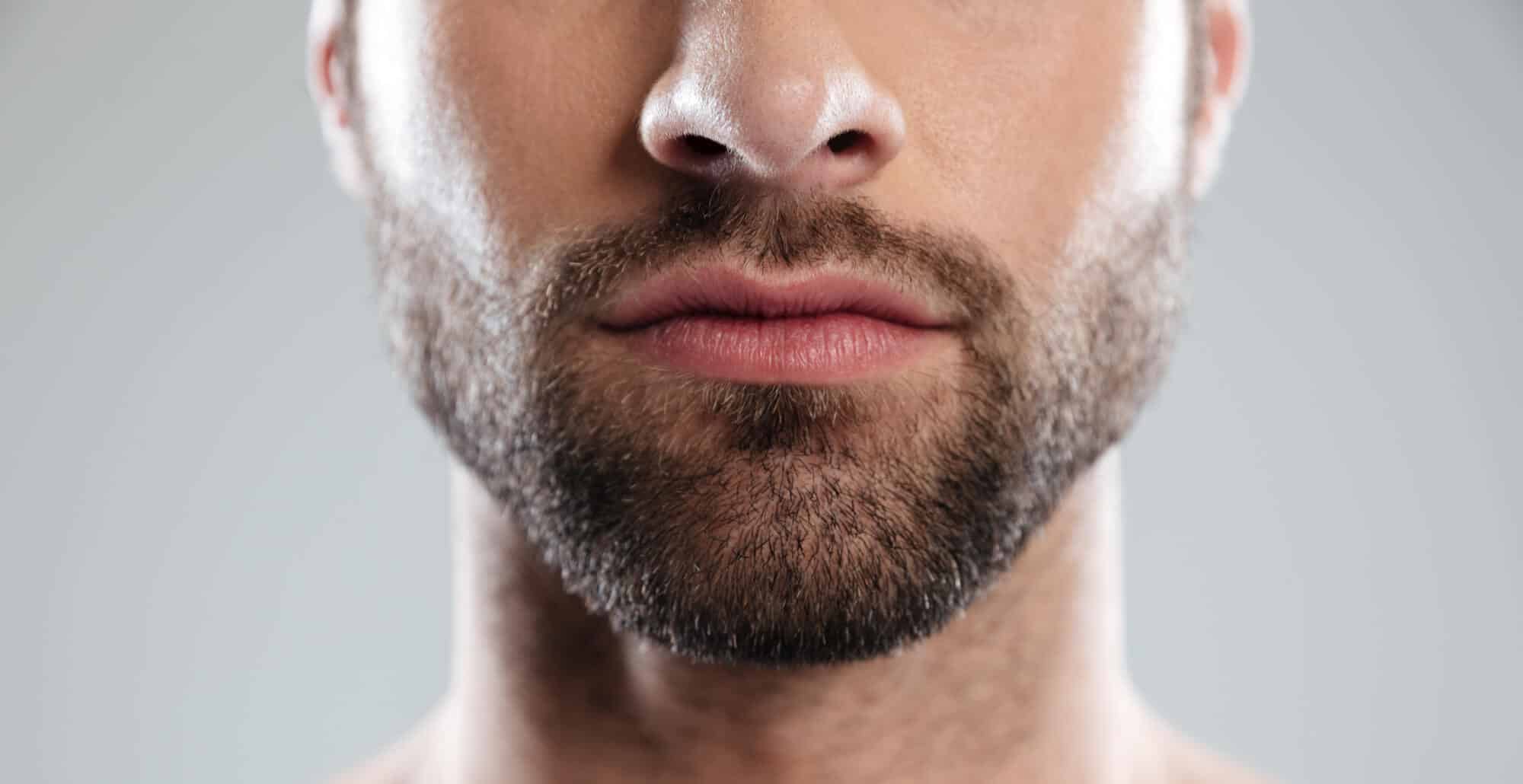 Épilation de la barbe chez l'homme : et si vous passiez au définitif ?