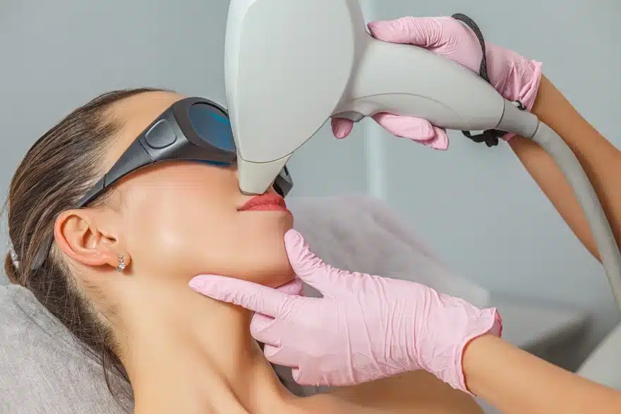 Duvet du visage : pourquoi faut-il choisir un professionnel pour l'épilation définitive ?