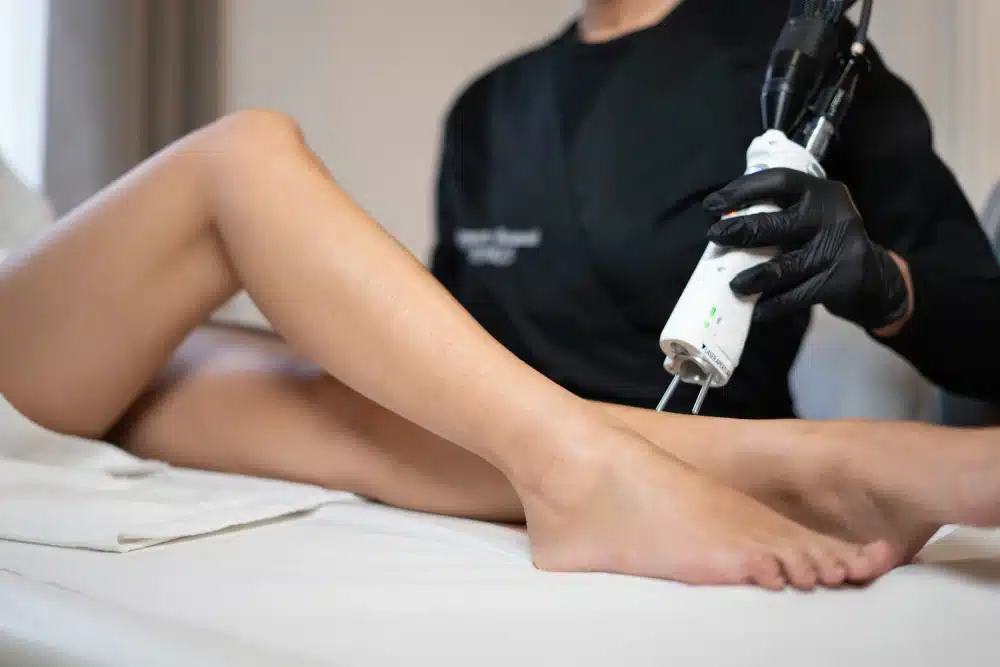 Épilation laser des mains et pieds pour femmes : fonctionnement et avantages
