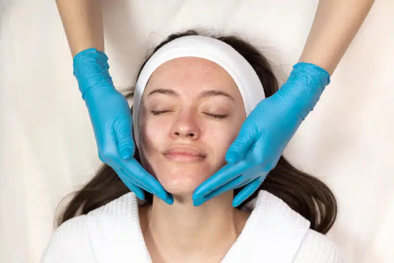 Peeling pour pores dilatés : la méthode pour resserrer vos pores