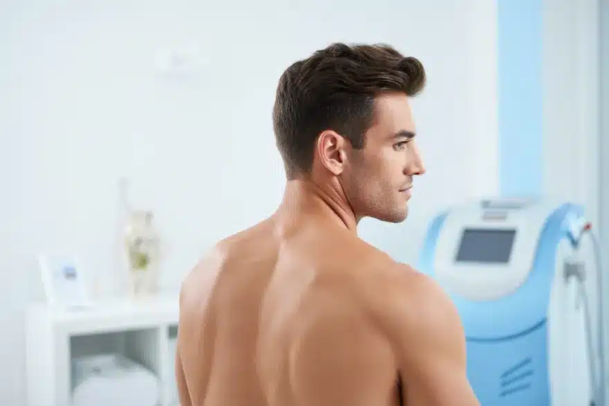 Dos sans poils : l’épilation laser idéale pour les hommes