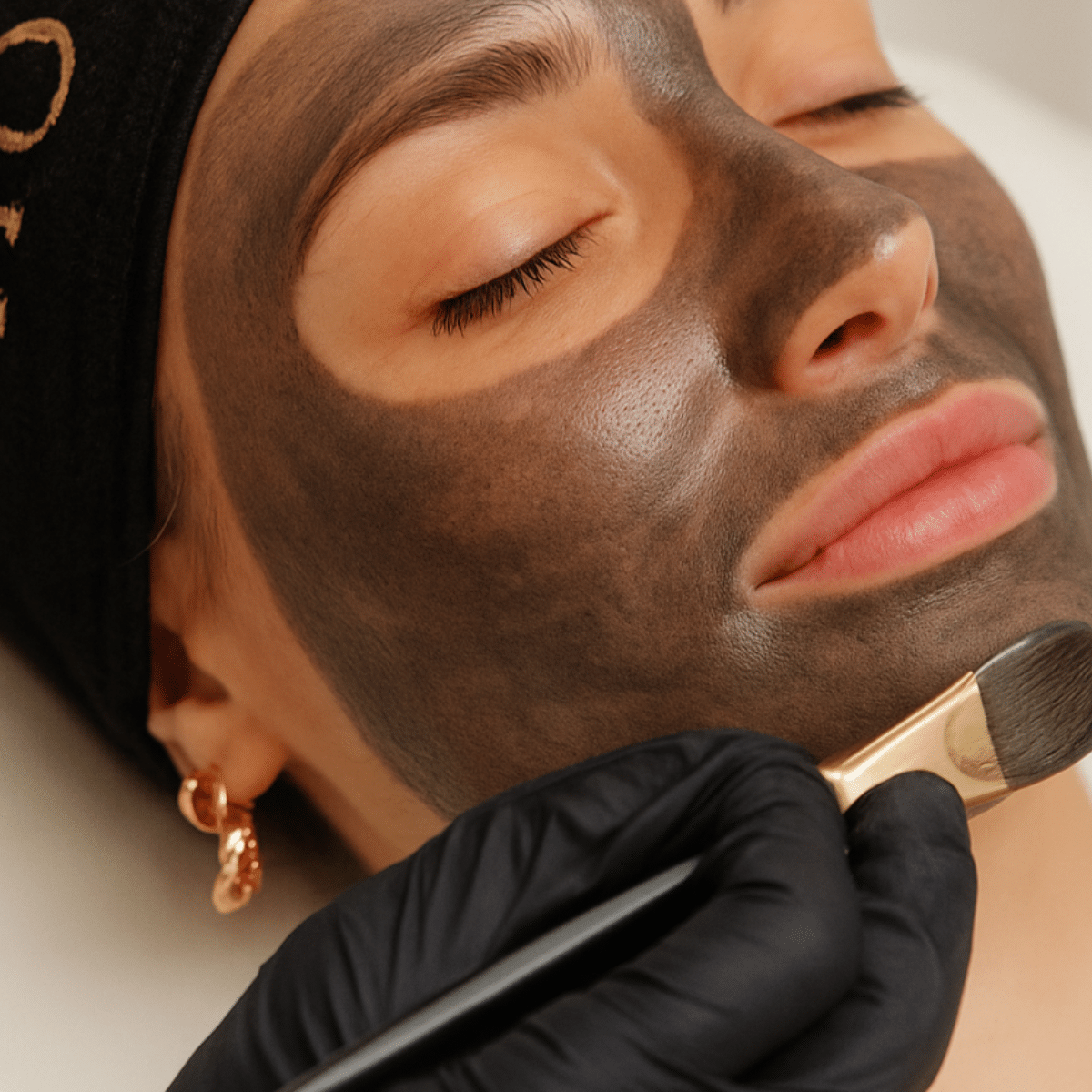 Carbon Laser Peel : rendez éclat et pureté à votre visage