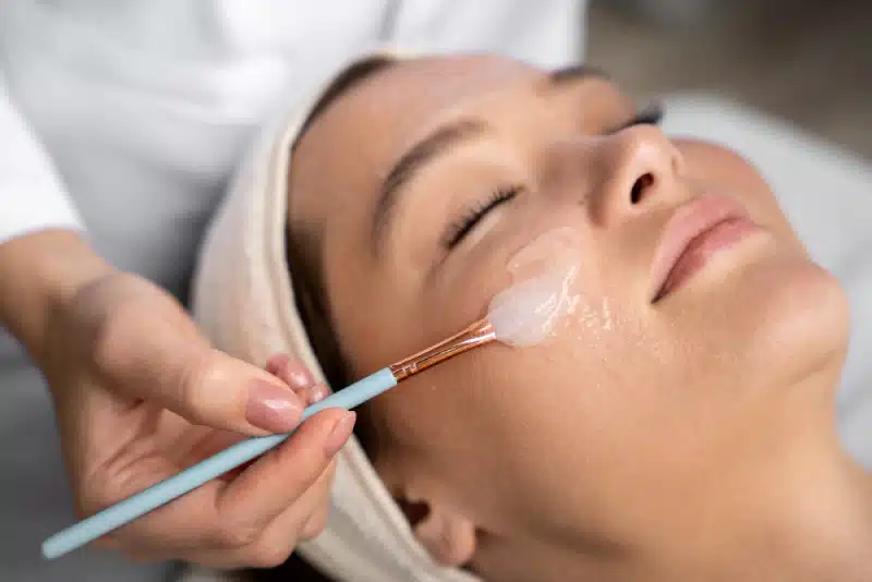 Peeling pour cicatrices du visage : solution ciblée et performante