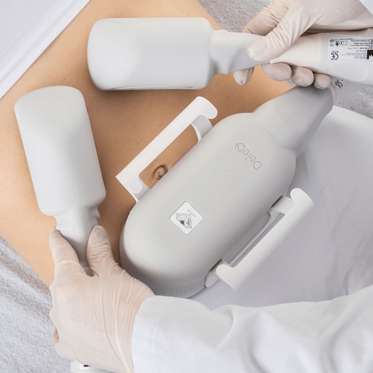 Quelles zones peuvent être traitées par coolsculpting ?