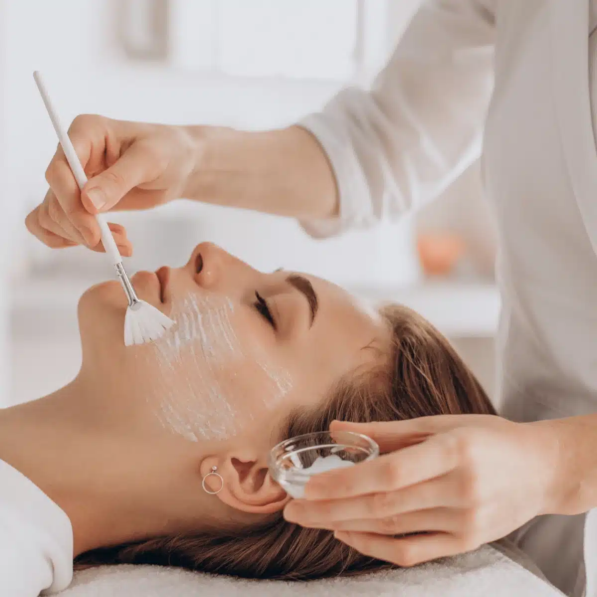 Indications du peeling 