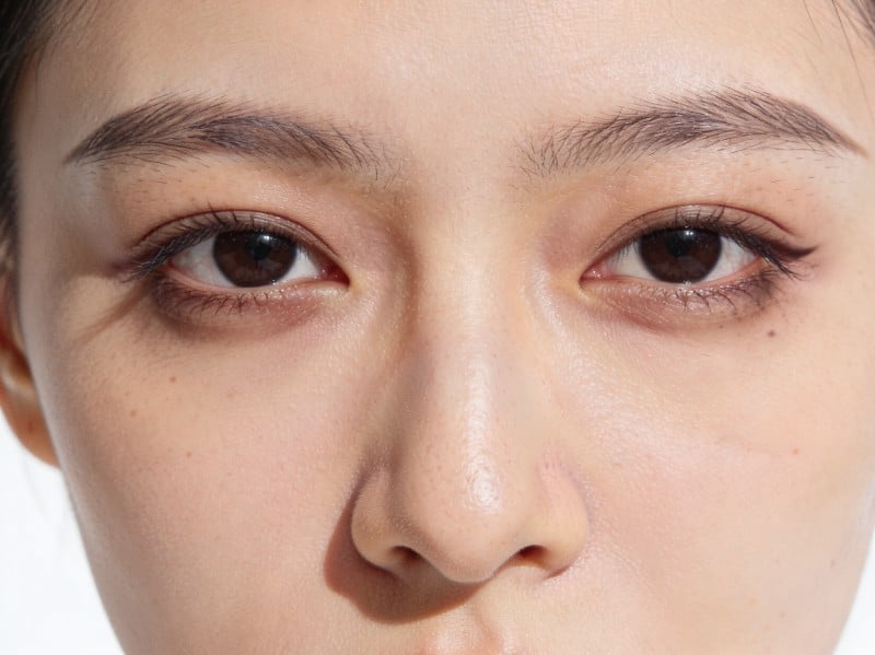 Comprendre les causes des cernes sous les yeux et comment y remédier